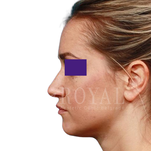 Plastic surgery | Before and after
