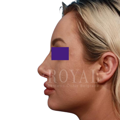 Plastic surgery | Before and after