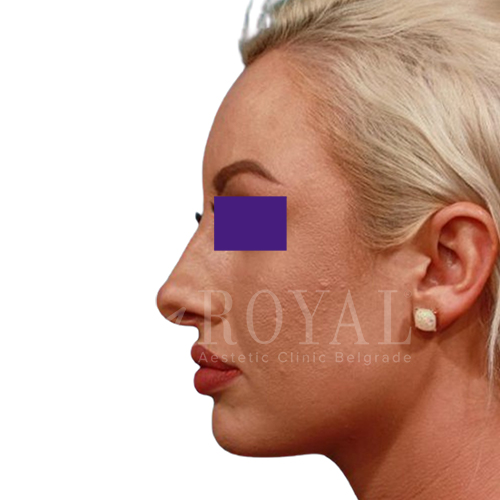 Plastic surgery | Before and after