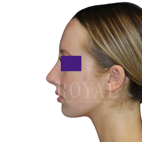 Plastic surgery | Before and after