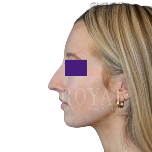 Plastic surgery | Before and after