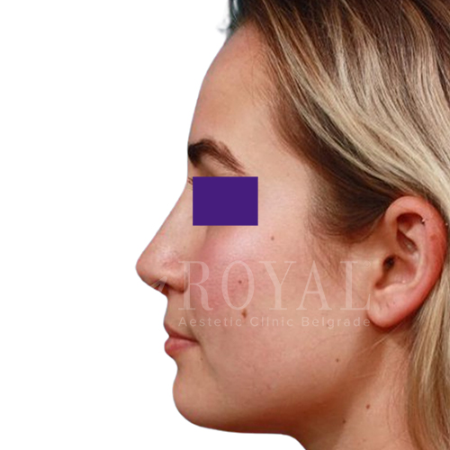Plastic surgery | Before and after