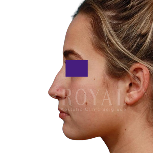 Plastic surgery | Before and after