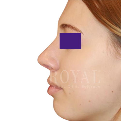 Plastic surgery | Before and after