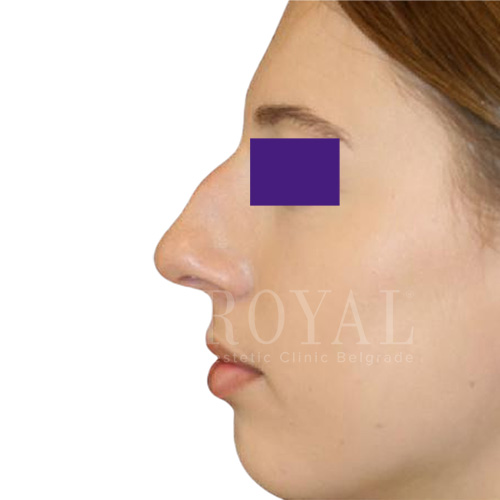 Plastic surgery | Before and after