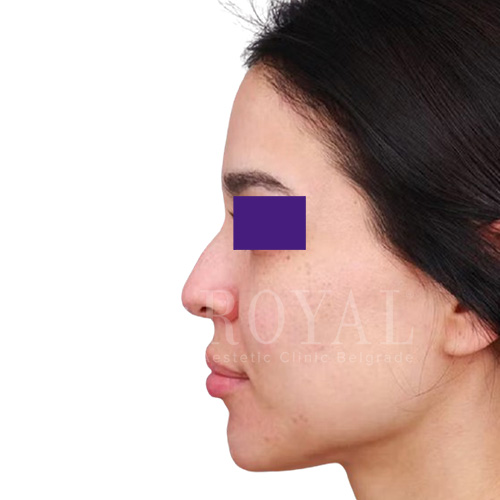 Plastic surgery | Before and after