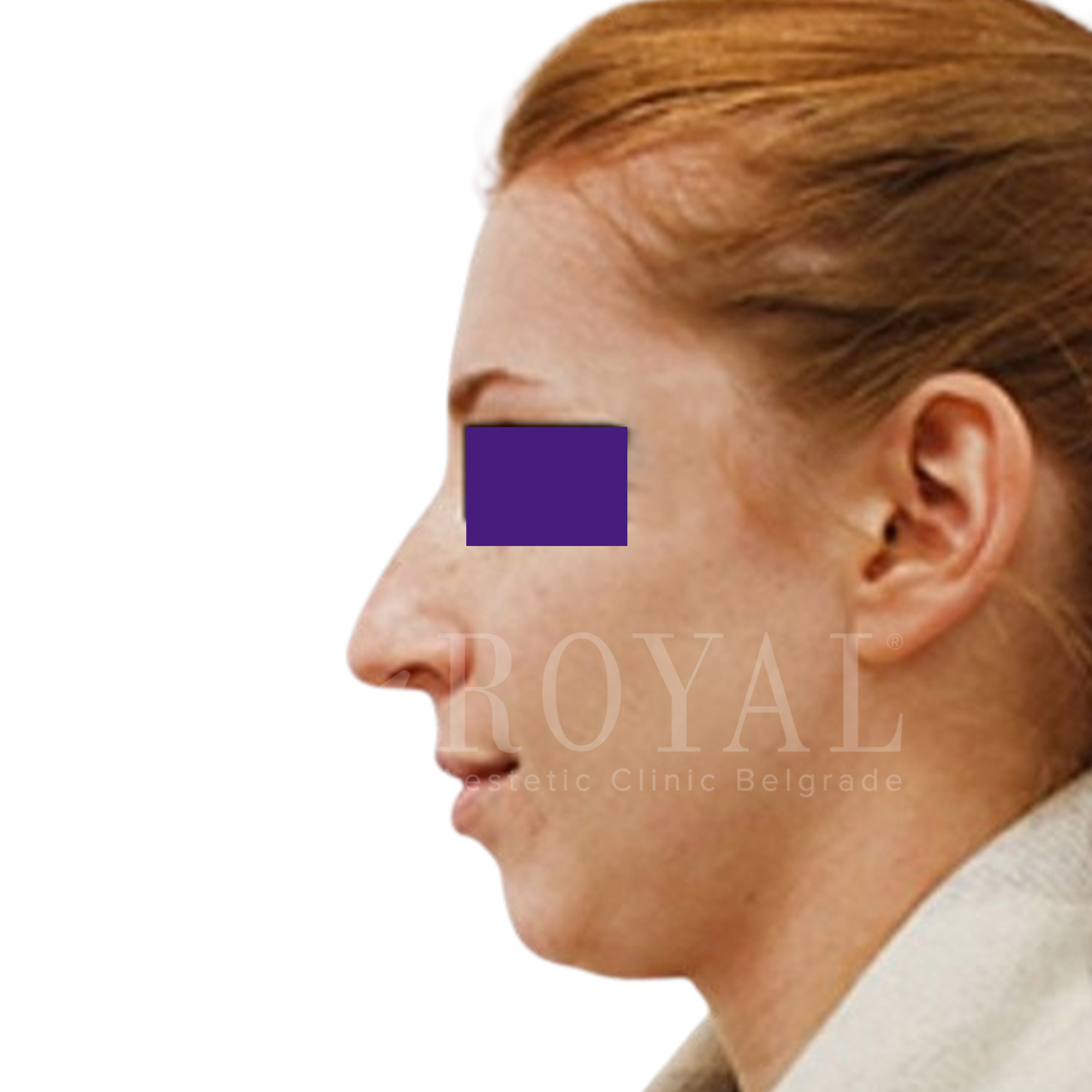 Plastic surgery | Before and after
