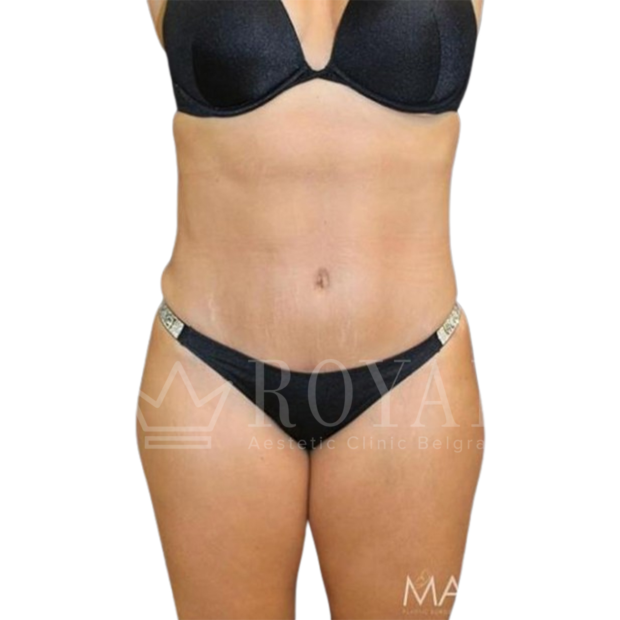 Plastic surgery | Before and after