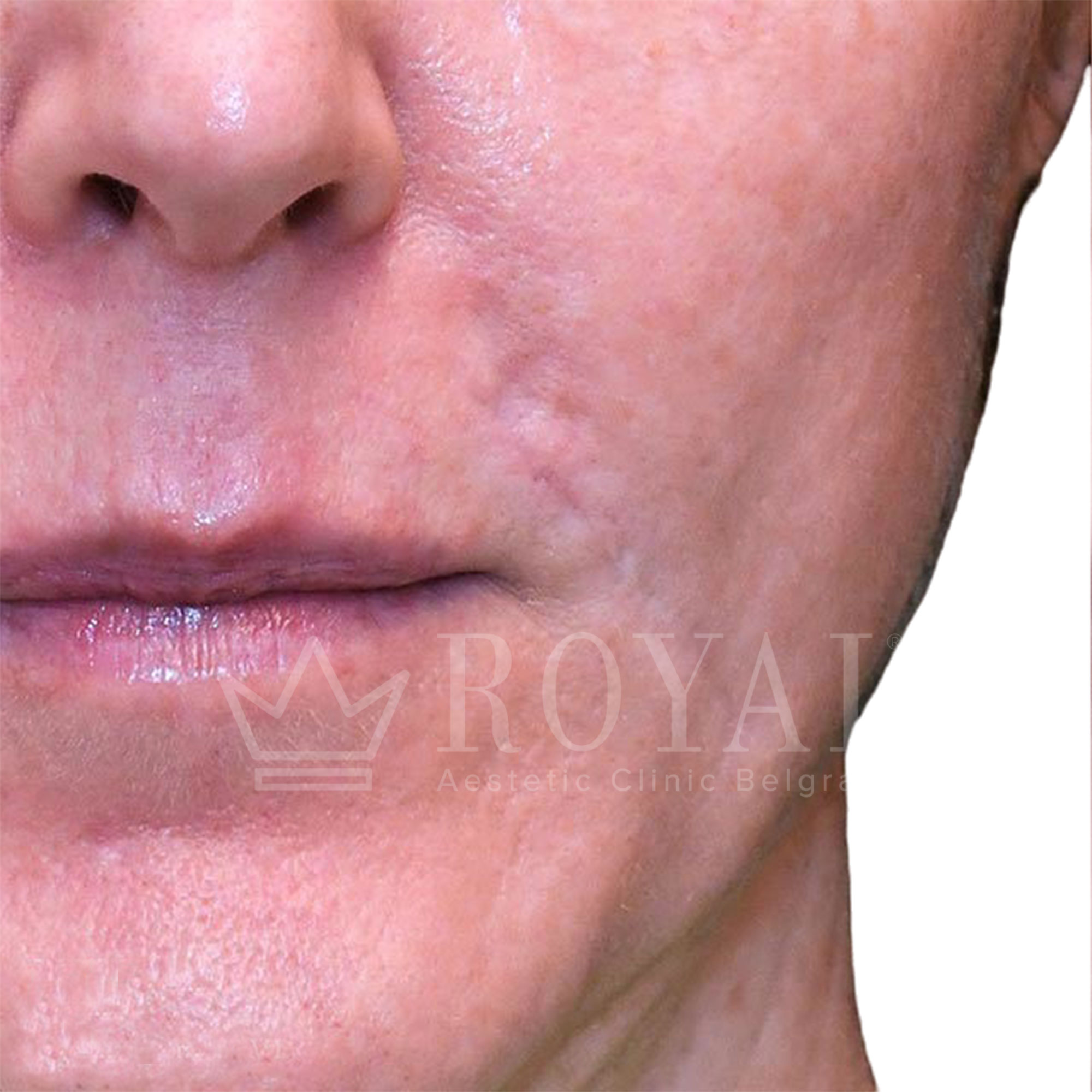 Plastic surgery | Before and after