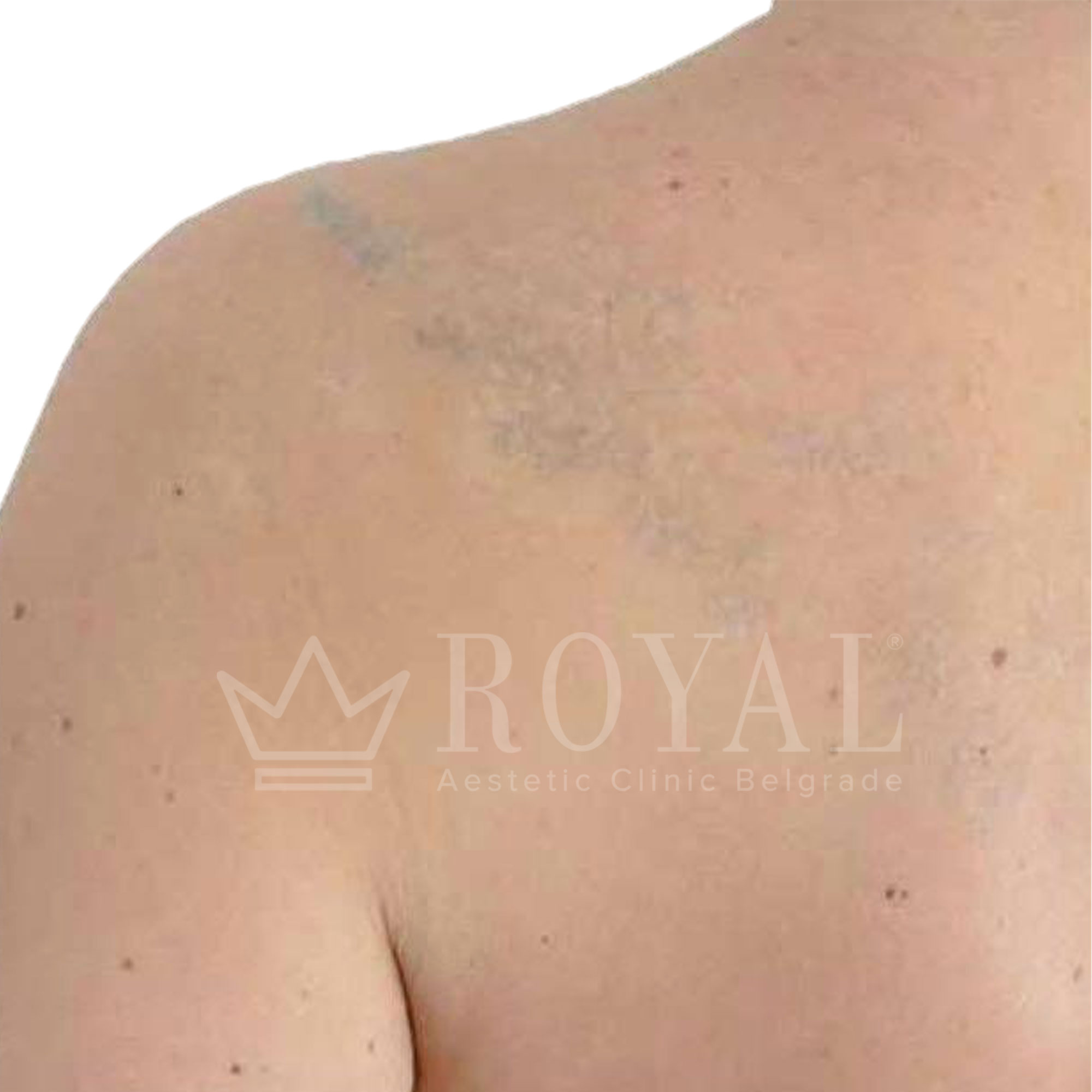 Plastic surgery | Before and after