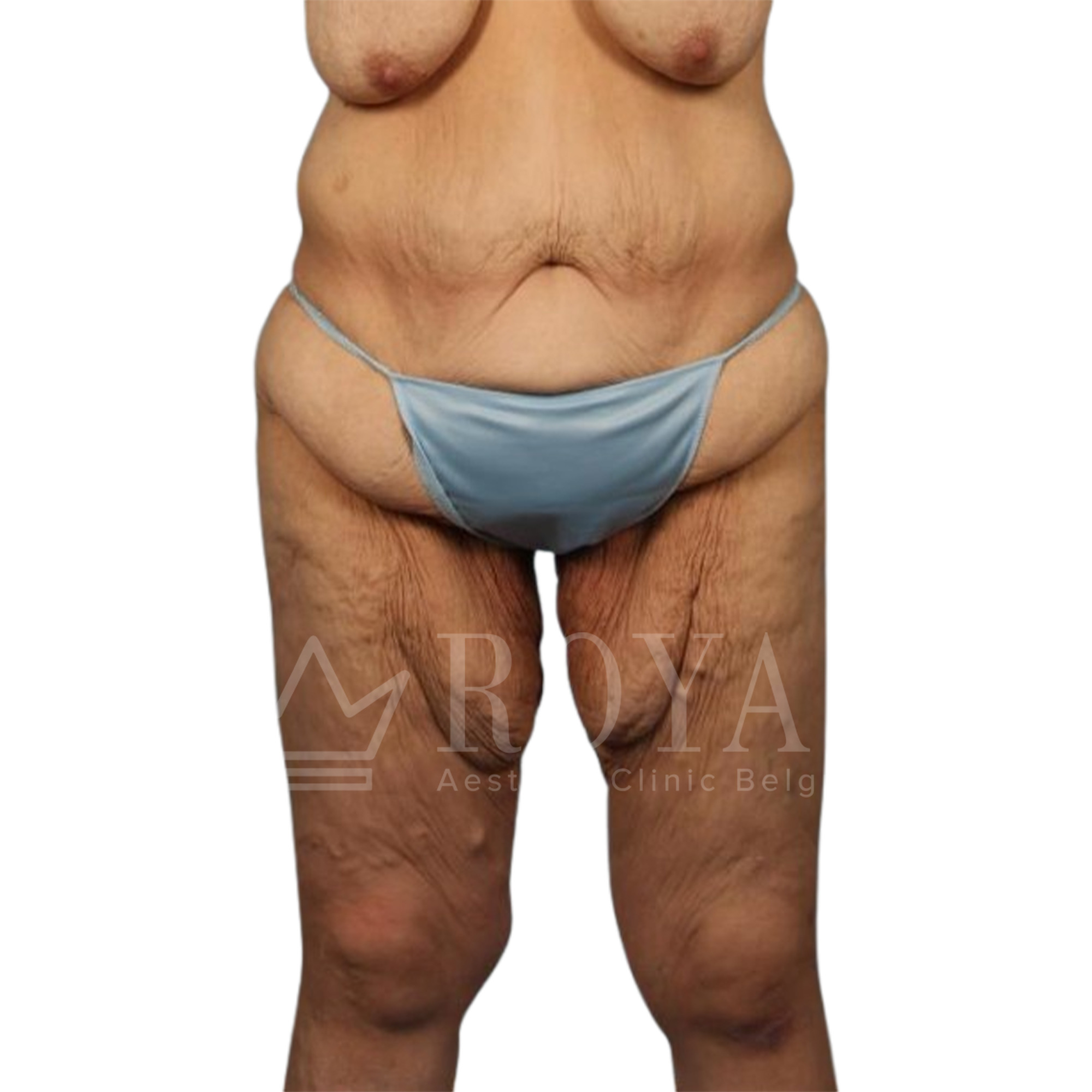 Plastic surgery | Before and after