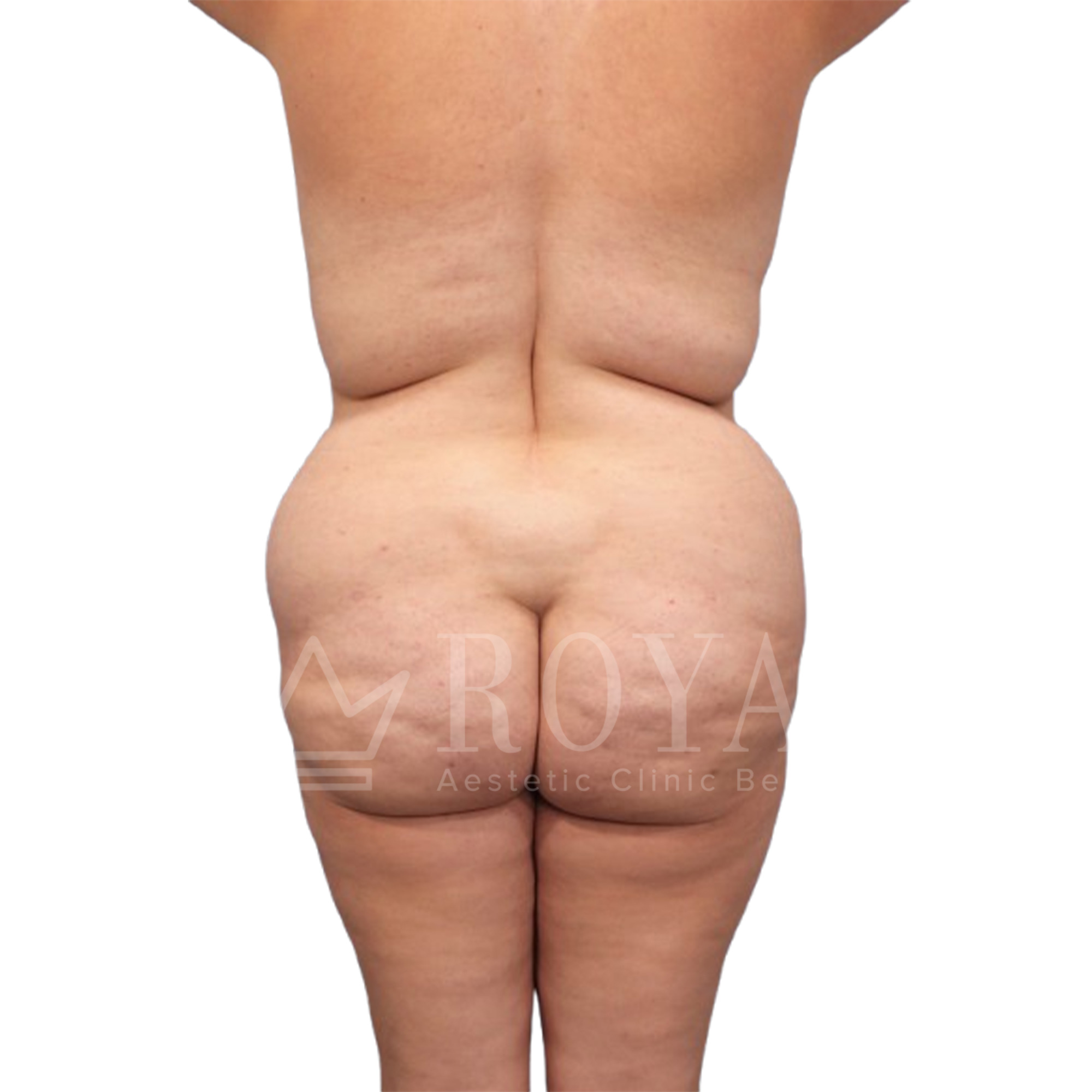 Plastic surgery | Before and after