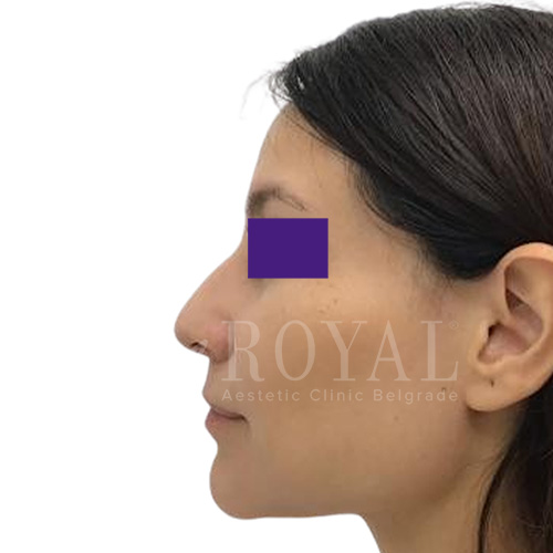 Plastic surgery | Before and after
