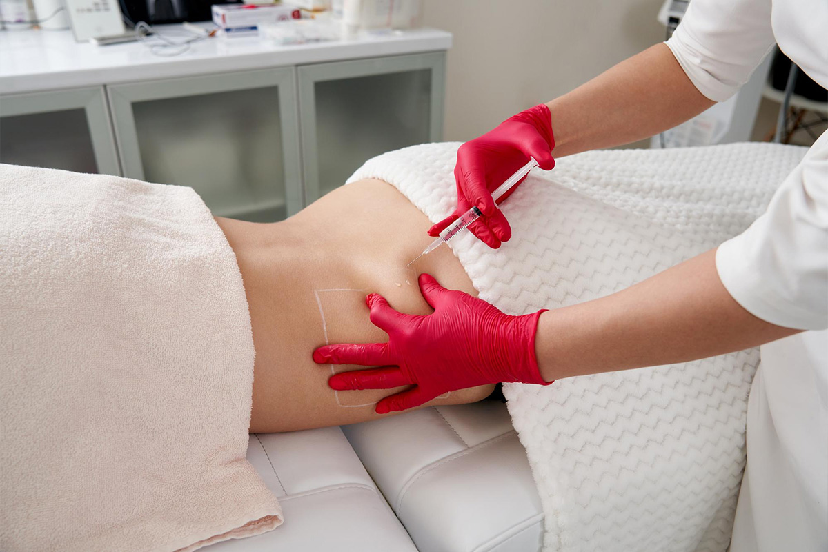 Liposukcija leđa | Liposukcija leđa