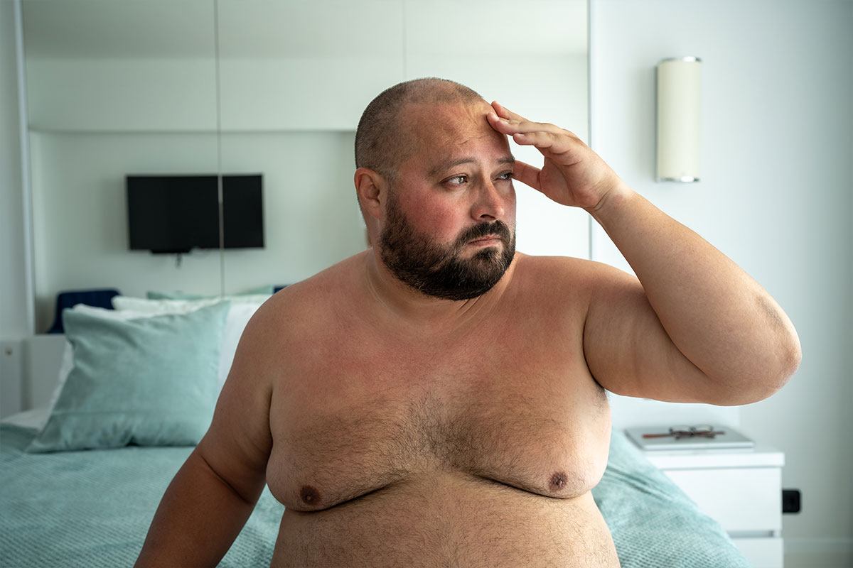 Plastic surgery | Gynecomastia