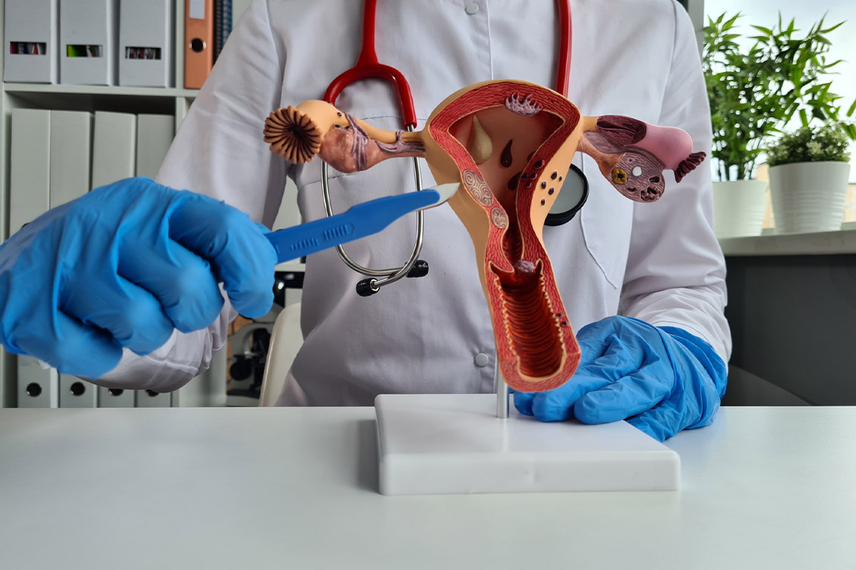 Removal of condylomas | Removal of condylomas
