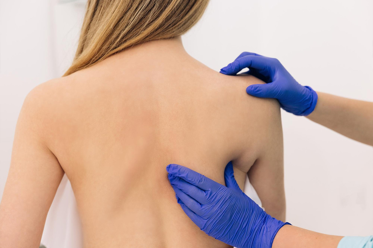Upper back liposuction | Upper back liposuction