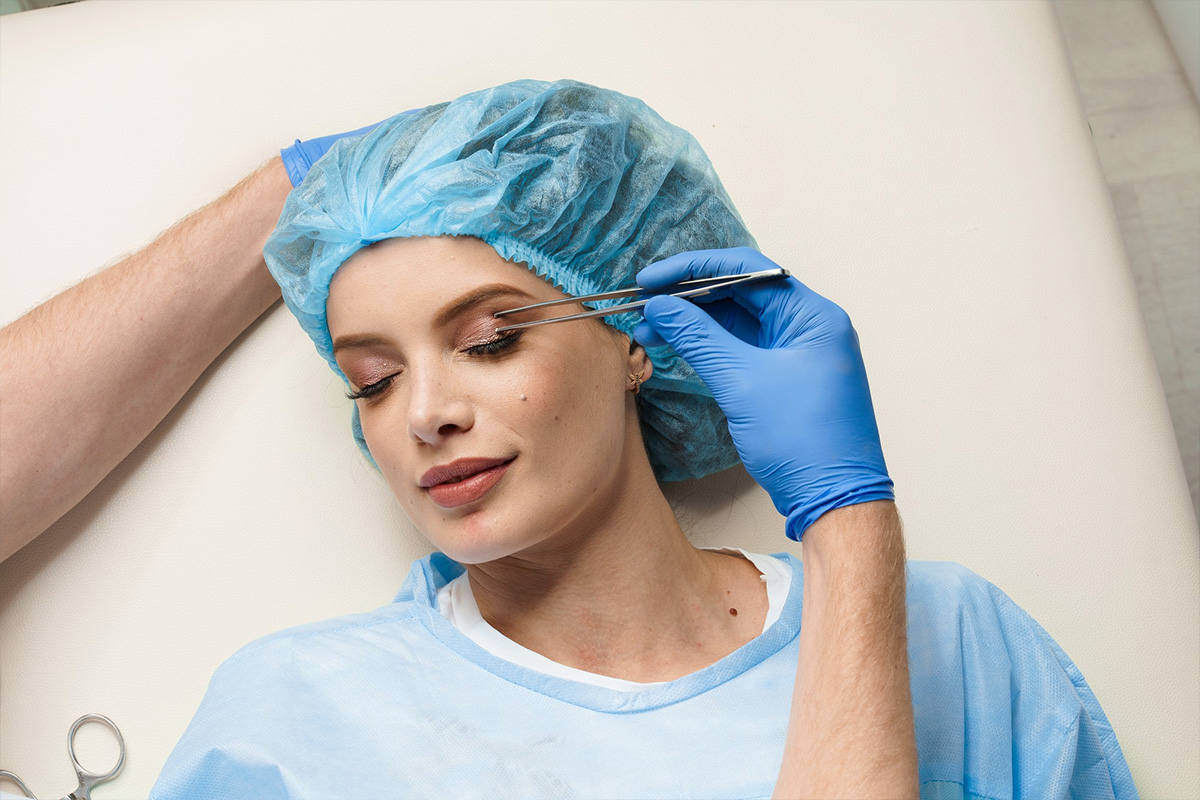 Plastic surgery | Upper eyelid surgery before and after