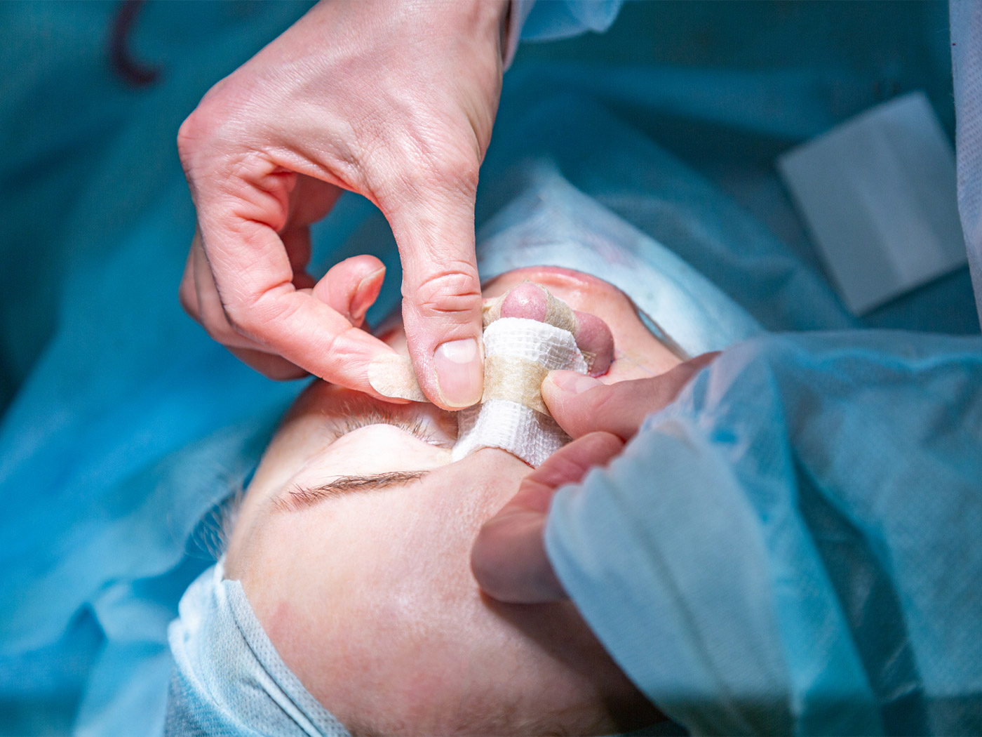 Plastic surgery | Nose surgery before and after
